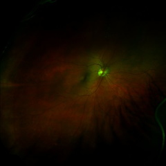 My moms eye through some kind of weird scan she had done to it