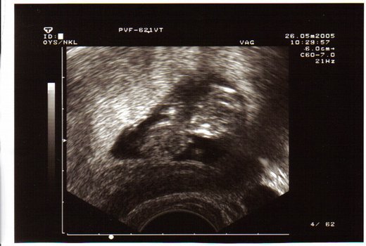 Little one expected to come early December